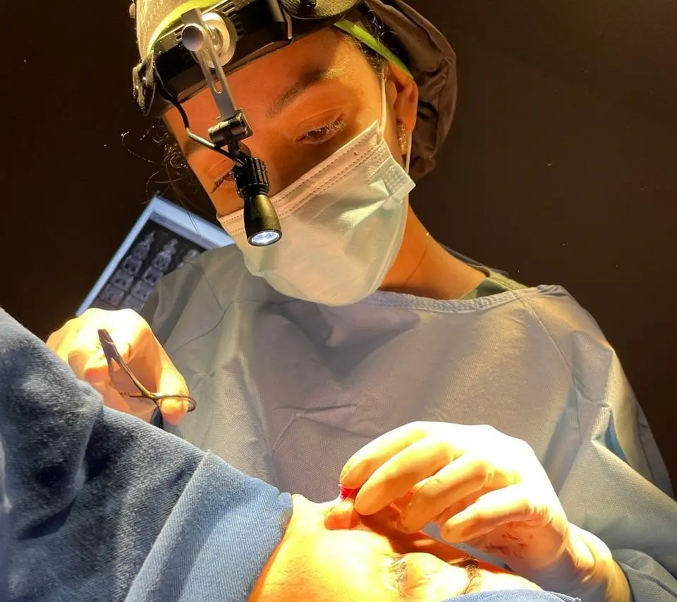 Resultado de Rinoplastia em Goiânia